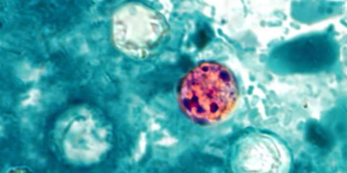 Cyclosporiasis cases rising in North Carolina as health officials urge food safety
