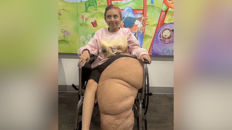 Jasmine Ramirez's medical journey began when she was just 2 years old.