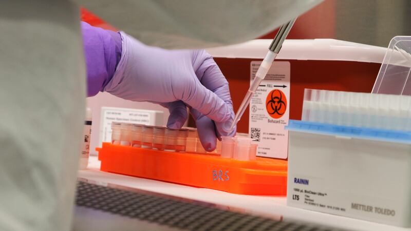 FILE - In this March 3, 2020, file photo, Hawaii state Department of Health microbiologist...