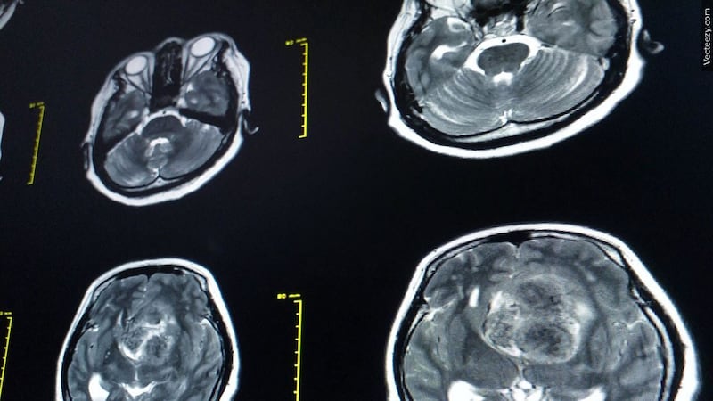 The event will focus on helping attendees better understand their brain, vascular and overall...