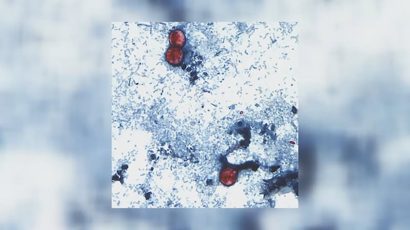 Haley Hompstead, a Monroe County resident — an area identified as a hotspot for the infection...